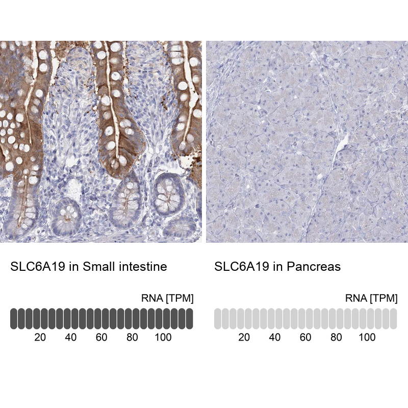 Anti-SLC6A19 Antibody