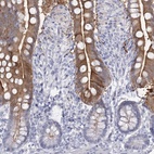 Immunohistochemical staining of human small intestine shows high expression.