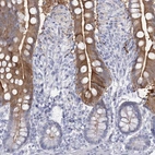 Immunohistochemical staining of human small intestine shows high expression.