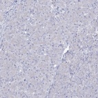 Anti-SLC6A19 Antibody