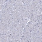 Immunohistochemical staining of human pancreas shows low expression as expected.