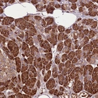 Anti-TARS Antibody