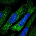 Immunofluorescent staining of human cell line U-2 OS shows localization to cytosol & actin filaments.