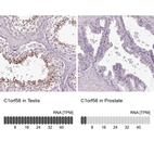 Anti-C1orf56 Antibody