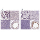 Immunohistochemical staining of human colon, liver, lymph node and testis using Anti-C1orf56 antibody HPA037429 (A) shows similar protein distribution across tissues to independent antibody HPA037430 (B).