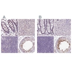 Immunohistochemical staining of human colon, liver, lymph node and testis using Anti-C1orf56 antibody HPA037429 (A) shows similar protein distribution across tissues to independent antibody HPA037430 (B).