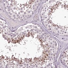 Immunohistochemical staining of human testis shows high expression.