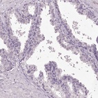 Immunohistochemical staining of human prostate shows low expression as expected.