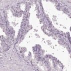 Immunohistochemical staining of human prostate shows low expression as expected.
