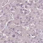 Immunohistochemical staining of human liver using Anti-C1orf56 antibody HPA037429.