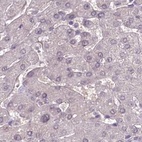 Anti-C1orf56 Antibody