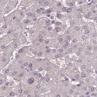 Immunohistochemical staining of human liver using Anti-C1orf56 antibody HPA037429.