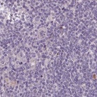 Immunohistochemical staining of human lymph node using Anti-C1orf56 antibody HPA037429.