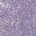 Anti-C1orf56 Antibody