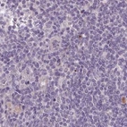 Immunohistochemical staining of human lymph node using Anti-C1orf56 antibody HPA037429.