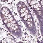 Immunohistochemical staining of human colon using Anti-C1orf56 antibody HPA037429.