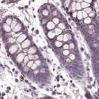 Immunohistochemical staining of human colon using Anti-C1orf56 antibody HPA037429.