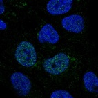 Anti-GCNT4 Antibody