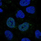 Immunofluorescent staining of human cell line RT4 shows localization to nucleoplasm & the Golgi apparatus.