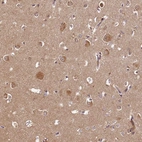 Immunohistochemical staining of human cerebral cortex shows moderate cytoplasmic positivity in neurons.