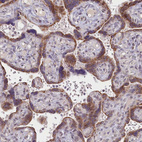 Immunohistochemical staining of human placenta shows moderate cytoplasmic positivity in trophoblastic cells.