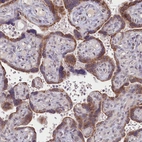 Immunohistochemical staining of human placenta shows moderate cytoplasmic positivity in trophoblastic cells.
