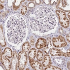 Immunohistochemical staining of human kidney shows moderate cytoplasmic positivity in cells in tubules and no positivity in cells in glomeruli as expected.