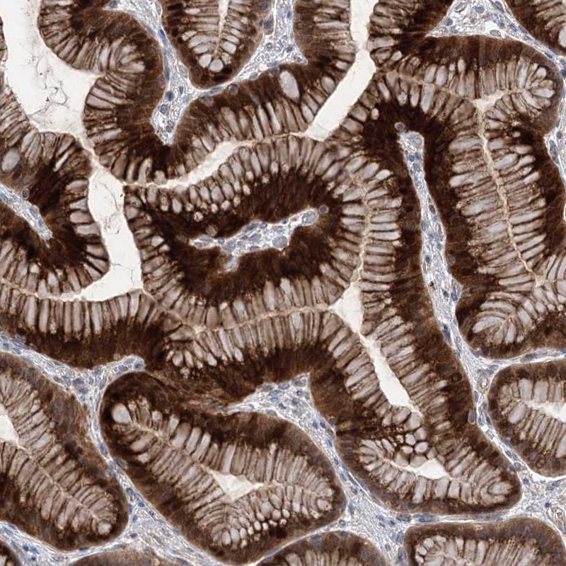 Anti-METTL24 Antibody