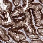 Anti-METTL24 Antibody