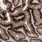 Anti-METTL24 Antibody