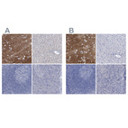 Immunohistochemical staining of human cerebral cortex, liver, lymph node and pancreas using Anti-SLC1A3 antibody HPA037468 (A) shows similar protein distribution across tissues to independent antibody HPA037467 (B).
