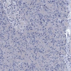 Immunohistochemical staining of human pancreas shows no positivity in exocrine glandular cells.