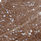 Immunohistochemical staining of human cerebral cortex shows strong cytoplasmic positivity in neuropil.