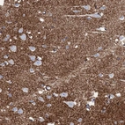 Immunohistochemical staining of human cerebral cortex shows strong cytoplasmic positivity in neuropil.