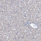 Immunohistochemical staining of human liver shows very weak positivity in hepatocytes.