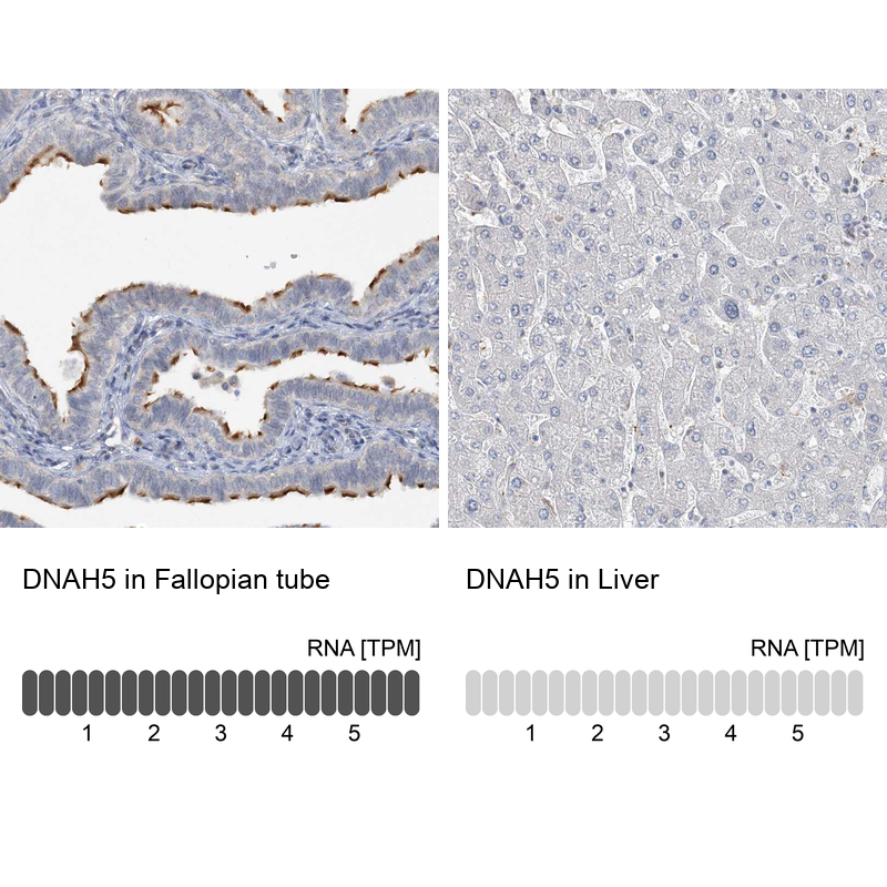 Anti-DNAH5 Antibody