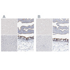 Immunohistochemical staining of human cerebral cortex, fallopian tube, liver and nasopharynx using Anti-DNAH5 antibody HPA037469 (A) shows similar protein distribution across tissues to independent antibody HPA037470 (B).