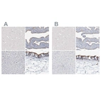 Immunohistochemical staining of human cerebral cortex, fallopian tube, liver and nasopharynx using Anti-DNAH5 antibody HPA037469 (A) shows similar protein distribution across tissues to independent antibody HPA037470 (B).