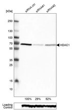 Western blot analysis in RT-4 cells transfected with control siRNA, target specific siRNA probe #1 and #2, using Anti-HDAC1 antibody. Remaining relative intensity is presented. Loading control: Anti-GAPDH.