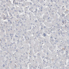 Immunohistochemical staining of human liver shows no positivity in hepatocytes as expected.