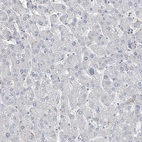 Immunohistochemical staining of human liver shows no positivity in hepatocytes as expected.
