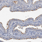 Immunohistochemical staining of human Fallopian tube shows strong positivity in cilia in glandular cells.