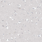 Immunohistochemical staining of human cerebral cortex shows no positivity in neurons as expected.
