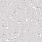 Immunohistochemical staining of human cerebral cortex shows no positivity in neurons as expected.