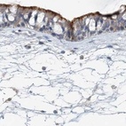 Immunohistochemical staining of human nasopharynx using Anti-DNAH5 antibody HPA037469.