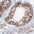 Immunohistochemical staining of human testis shows strong nuclear positivity in cells in seminiferous ducts.