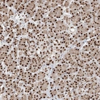 Immunohistochemical staining of human pancreas shows strong nuclear positivity in exocrine glandular cells.