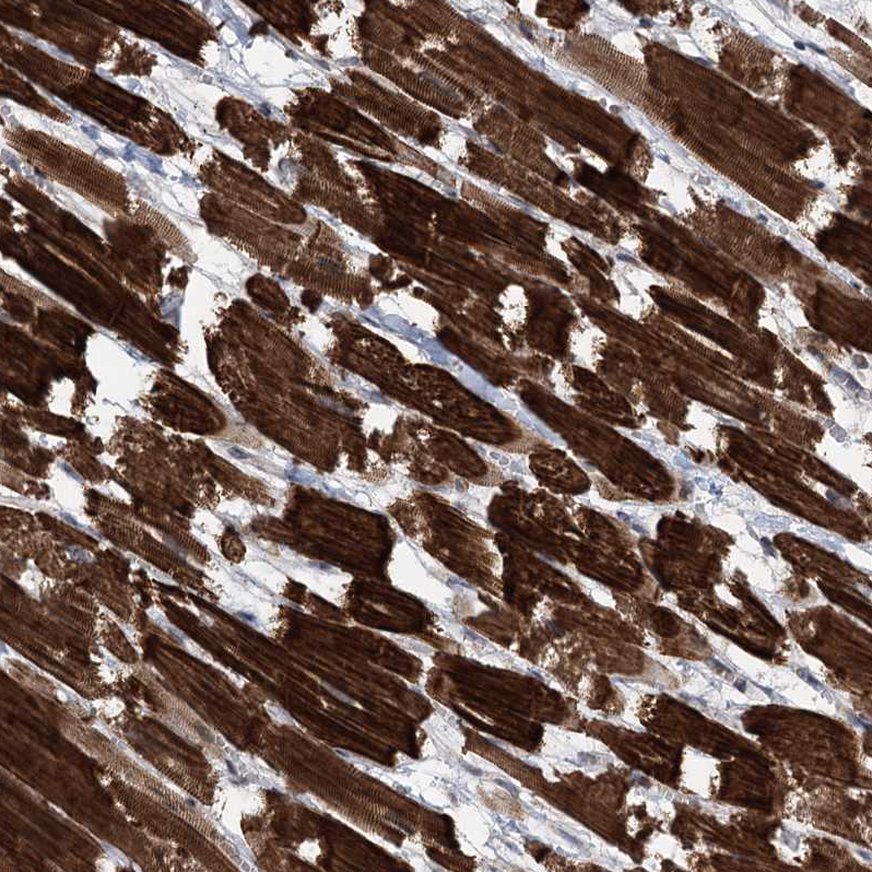 Anti-CCSER2 Antibody