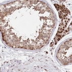 Immunohistochemical staining of human testis shows moderate cytoplasmic positivity in cells in seminiferous ducts.