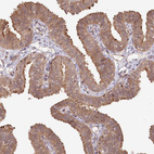 Immunohistochemical staining of human fallopian tube shows moderate cytoplasmic positivity in glandular cells.